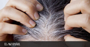 pelos con canas