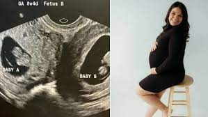 UTERO DOBLE